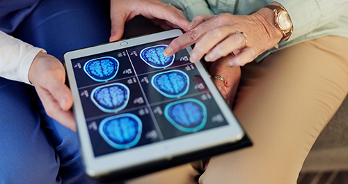 BlogPost4 ANurseandpatientreviewingbrainscanimages 500px