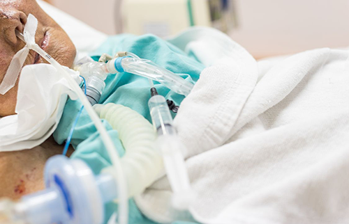 BlogPost5 patient resting after EVD drain