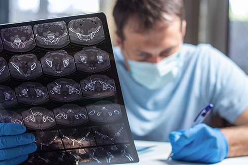 BlogPost neuroscience nurse practitioners helping stroke patients 500px